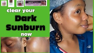 Whitening Facial Creams to clear Sunburn fast face cream reviews for uneven skin amphyperpigmentation [upl. by Christyna]