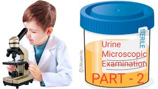 Urine microscopyUrine castGranular casturine microscopic examination [upl. by Allerie773]