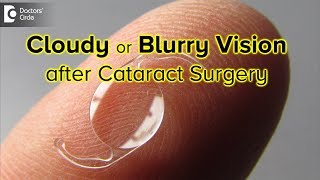 How long is your vision blurry or cloudy after cataract surgery  Dr Sriram Ramalingam [upl. by Gauldin]