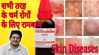 Sulphur Mother Tincture ko kaun kaun si skin disease चर्म रोग में use Karen aur kaise use Karen [upl. by Carl]