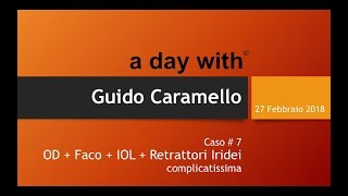 27 feb 2018 ADW Guido Caramello  caso7 [upl. by Enyawud]