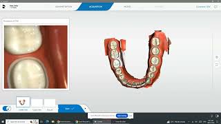 Primescan Scanning Techniques [upl. by Anirret915]