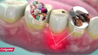 How Colgate Pain Out Works [upl. by Lehsar]