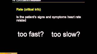 1215 Lead ECG Step by Step Approach [upl. by Airt]