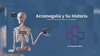 Video Presentación Sobre La Acromegalia Y Su Historia  Enciclopedia Médica [upl. by Aihtniroc662]