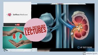 RENAL PATHOLOGY lecture 22 UROLITHIASIS made easy [upl. by Radcliffe]