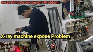 X ray machine not exposing  X ray machine problems  xray film not visible Prince vlogs 23 [upl. by Jodee]