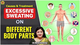 How To Stop Excessive Sweating  Acupressure Points  Dr Richa Varshneys Free Online Training [upl. by Leind]