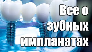 Всё что вы хотели узнать о зубных имплантах  Доктор Туран Гюльдаш [upl. by Brantley]