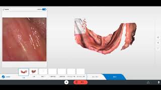 Scan fully edentulous with Primescan [upl. by Hgielak294]