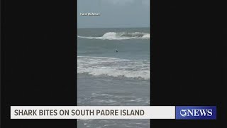 Shark bites on South Padre Island [upl. by Avon]