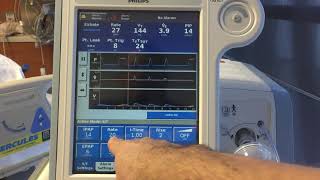 NonInvasive Ventilation NIV  Basics [upl. by Ryley659]