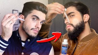 Como usar MINOXIDIL para crescer BARBA 🧔🏻‍♂️ [upl. by Llerdnam]