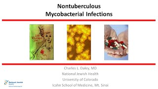 Nontuberculous Mycobacterial Infections 2019 [upl. by Weinshienk349]