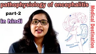 Encephalitis part2  pathophysiology  symptoms  treatment in hindi  medical Destination [upl. by Aryl570]