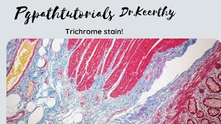 Masson trichrome stain [upl. by Rehnberg]