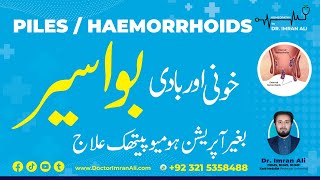 Piles Hemorrhoids Homeopathic Treatment Without Operation With Best Medicines  Dr Imran Ali [upl. by Larrej]