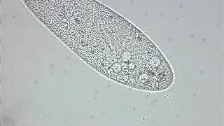 paramecium contractile vacuole [upl. by Docila]