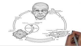 Acanthamoeba lecture [upl. by Jadda]