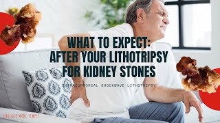 What to expect after your Lithotripsy procedure for Kidney Stones 2020  ESWL  Shockwave Therapy [upl. by Anegal]