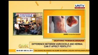 Varicocele VS Hernia  Can it affect fertility  Usapang Pangkalusugan [upl. by Maddeu]