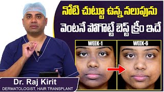 నోటిచుట్టూ నలుపు పోవాలంటే  How to Remove Pigmentation Around Mouth Naturally  Celestee Skin Clinic [upl. by Meadows]