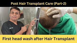 First hair wash after hair transplant  How to do normal water wash [upl. by Aniakudo]