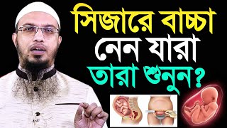 মহিলাদের সিজারে বাচ্চা হলে কি হয় অধিকাংশ মানুষ জানেই না শায়খ আহমাদুল্লাহ [upl. by Warner729]