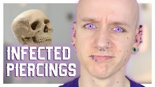 Infected Piercings amp How To Heal Them  Piercing FAQ 21  Roly [upl. by Killarney576]