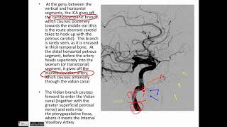 Cerebral arterial anatomy and cerebral angiography part 1 [upl. by Gow]