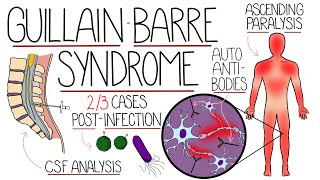 Guillain Barre Syndrome Explained Clearly Including Subtypes [upl. by Lleynad]