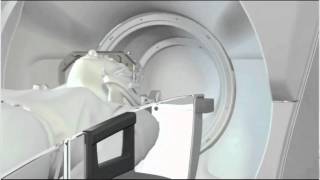 Gamma Knife Perfexion  How It Works [upl. by Lisette]