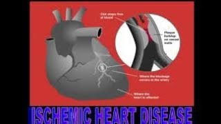 Ischemic Heart DiseaseDefinition of ischemic heart disease  Causes of ischemic heart disease✨ [upl. by Atir]