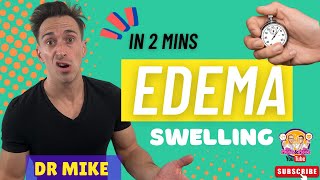 Edema Oedema  In 2 minutes [upl. by Aned]