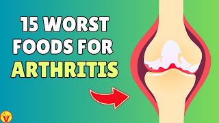 15 Foods To Avoid For Arthritis  WORST Foods For Arthritis Joint Pain amp Inflammation  VisitJoy [upl. by Heber]