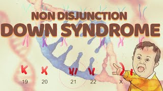 Nondisjunction Down Syndrome  Chromosome 21  Trisomy [upl. by Sweatt946]