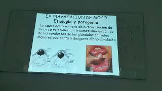 Gastroenterologia teórica Patologias de las glándulas salivales 12032024 [upl. by Cowan]