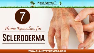 7 Home Remedies for Scleroderma [upl. by Edlun431]