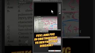 WHAT HAPPENS TO FEV1 AND FVC IN OBSTRUCTIVE AND RESTRICTIVE LUNG DISEASESfcpsquestionbankfcps [upl. by Ayikat]