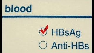 What does HBsAg positive means  HBsAg positive symptoms  HBsAg positive treatment [upl. by Lihcox]