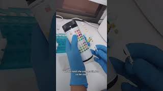 Urinanalysis part 1 Physical Examination of urine in 5 minutes [upl. by Lenahtan]