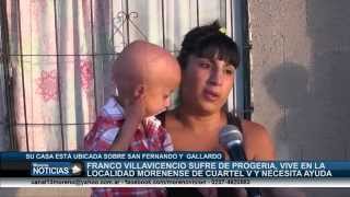 Franco Villavicencio tienen progeria Vejez Prematura y necesita ayuda 0111530804973  mamá Yesica2 [upl. by Nekcerb175]