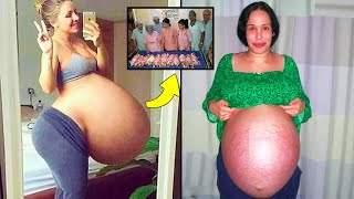 10 Most Unusual Pregnancy Conditions You Wont Believe Are Real [upl. by Hills]