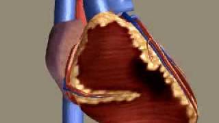 Myocardial Infarction [upl. by Jacquette]