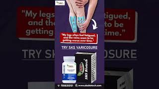 Say goodbye to tired aching legs and visible veins with Varicosure from SKS Biotech varicoseveins [upl. by Elvira957]