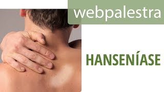 Webpalestra  Hanseníase diagnóstico precoce na ABS [upl. by Henrieta80]