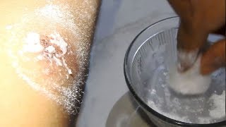 Most powerful home remedy for every purposes – BORIC ACIDPOWDER [upl. by Aneladgam]