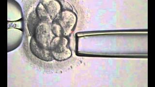 Laserassisted Blastomere Biopsy using Hamilton Thorne laser [upl. by Adnotal826]