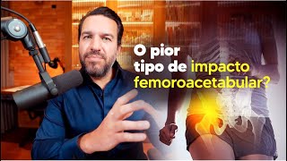 Tipos de Impacto Femoroacetabular  Dr David Gusmão [upl. by Laurene]