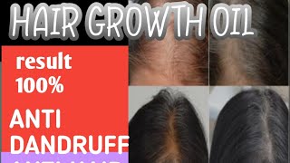 hair growth oil hair growth rosemary oil for hair growth hair growth tips wild growth hair oil [upl. by Barlow]